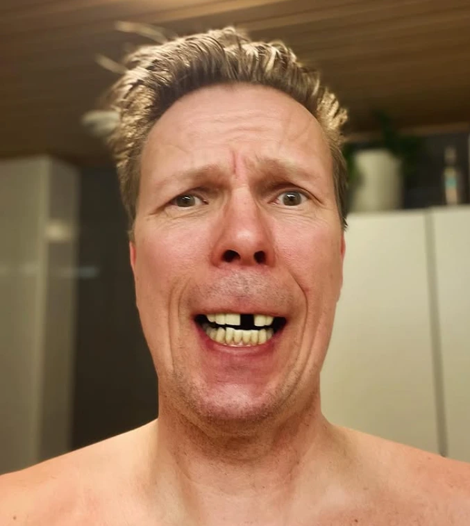 jukka rasila hampaat